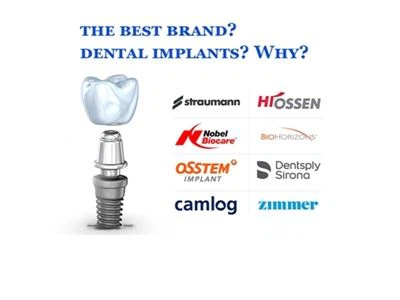 Qual è la migliore marca di impianti dentali? Perché?